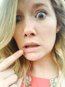 doctor google, lip-blister